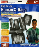 True to Life Human X-rays